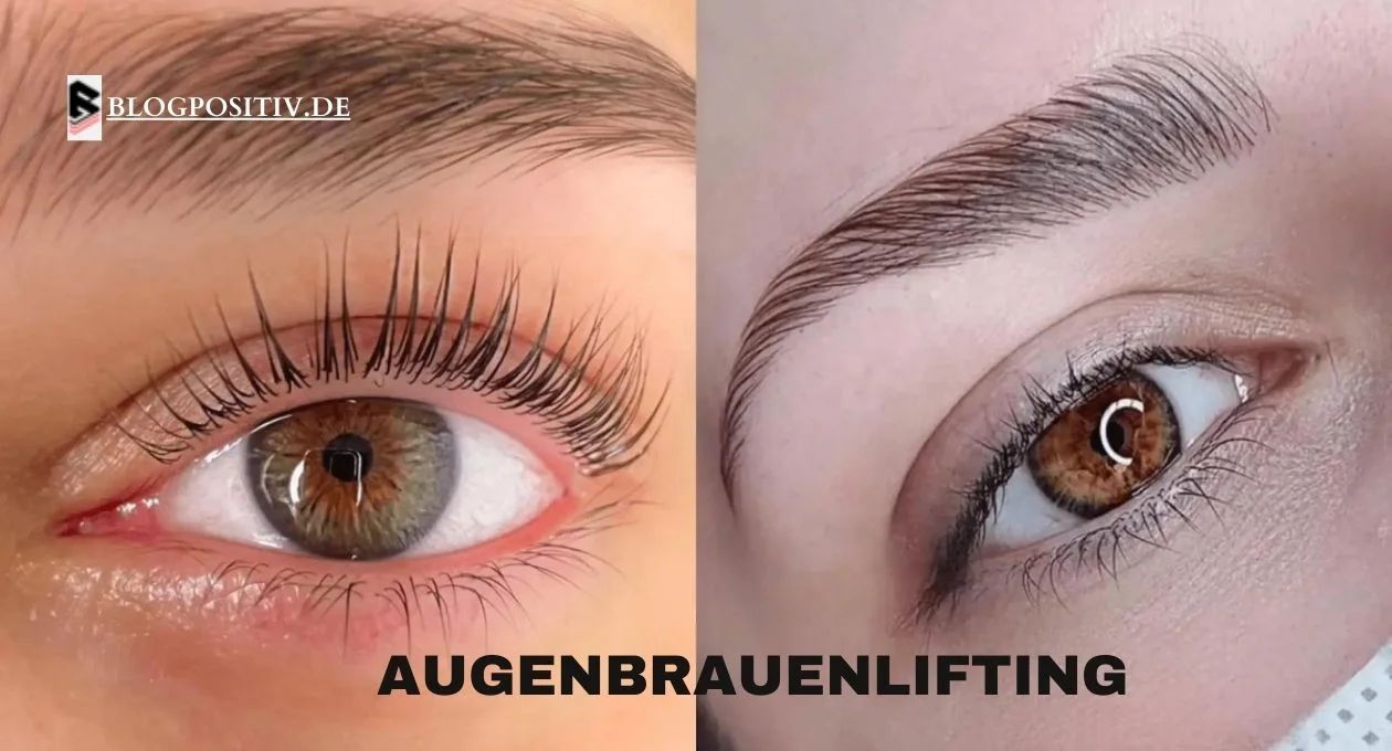 Augenbrauenlifting
