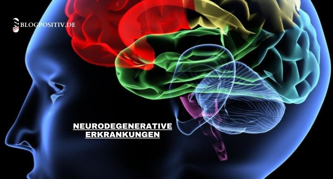 neurodegenerative erkrankungen